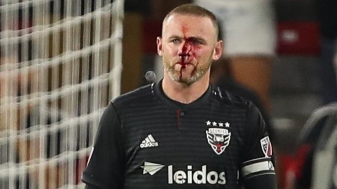 Wayne Rooney és a vér - videó